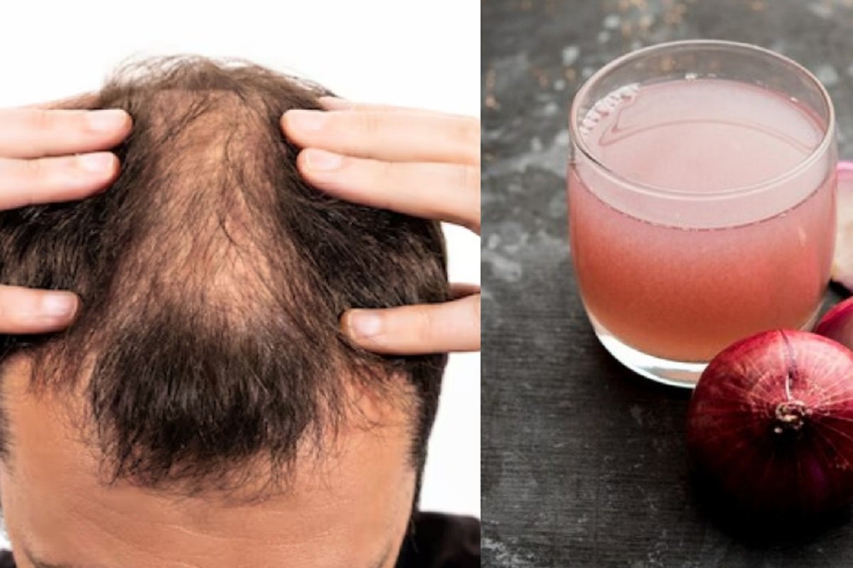 Hair Care Tips: Onion juice helps make hair thick, strong and long