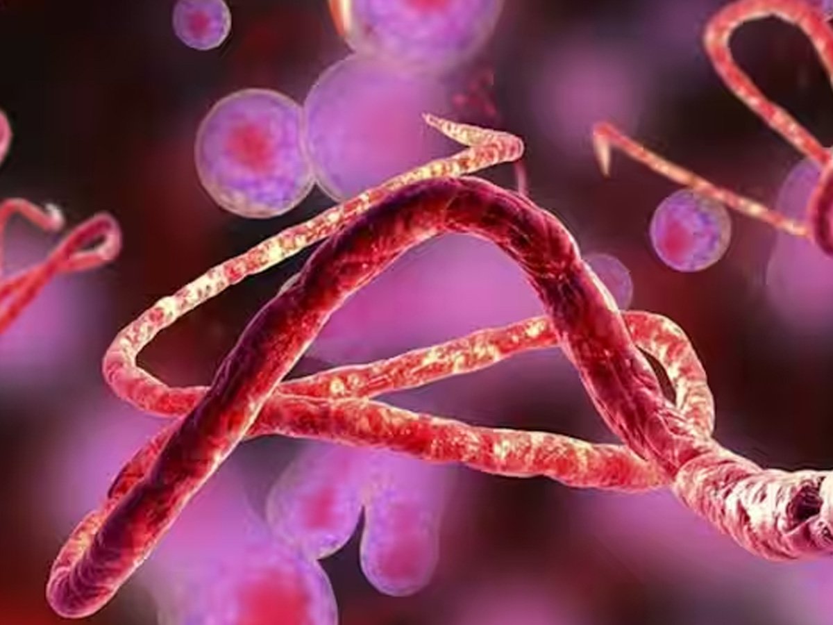 Ebola virus has entered Rajasthan! Health Department on alert