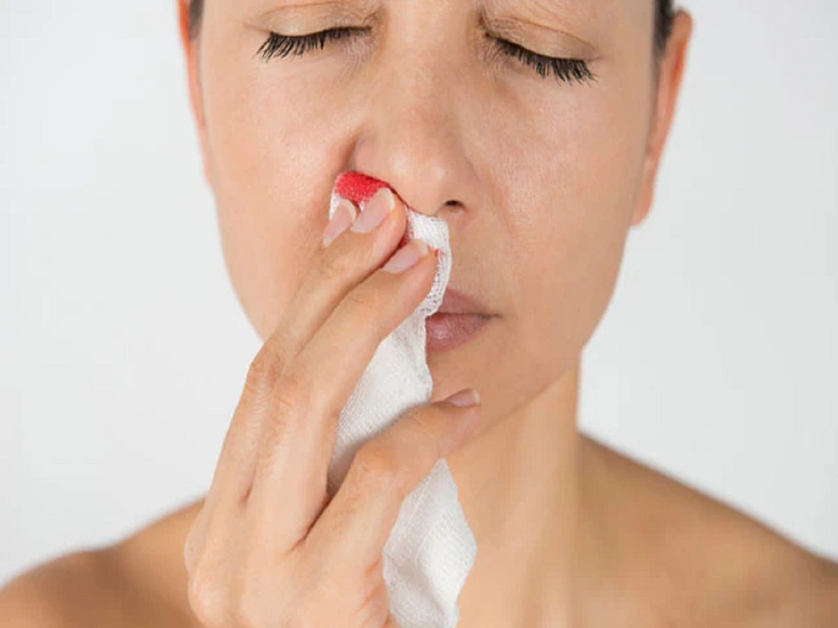 Health Tips: Frequent nosebleeds could be a symptom of this condition.