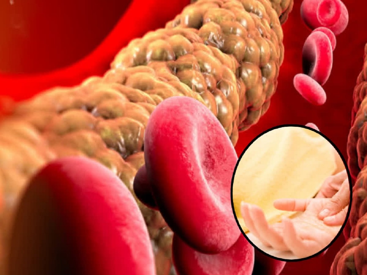 Health Tips: Include these items in your diet and the cholesterol accumulated in your arteries will melt away like wax.